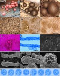 Attēlu rezultāti vaicājumam “Lycogala cf. oleocrystalliferum spores”