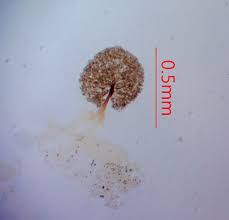 Attēlu rezultāti vaicājumam “Licea pusilla sessile”