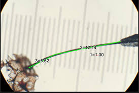 Attēlu rezultāti vaicājumam “Stemonitopsis aequalis var. microspora macro”