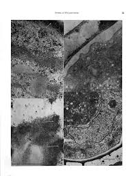 Attēlu rezultāti vaicājumam “Physarum flavicomum spores”
