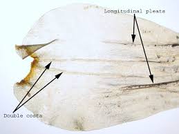 Attēlu rezultāti vaicājumam “Rhytidiadelphus triquetrus sporophyte”