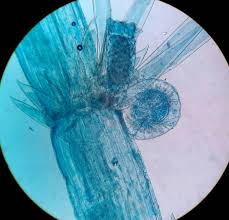 Attēlu rezultāti vaicājumam “Chara aspera male”