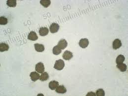 Attēlu rezultāti vaicājumam “Hemitrichia serpula spores”