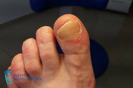 Znalezione obrazy dla zapytania palec