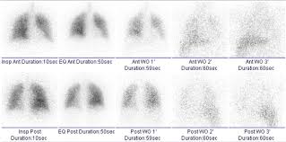 Image result for  v    q