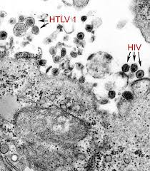 Image result for фотография вируса вич