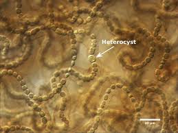 Attēlu rezultāti vaicājumam “Nostoc commune cells”