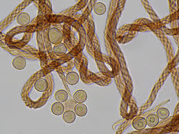 Attēlu rezultāti vaicājumam “Metatrichia floriformis”