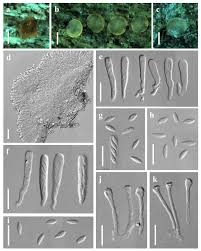 Attēlu rezultāti vaicājumam “Orbilia sp.”