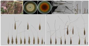 Attēlu rezultāti vaicājumam “Comatricha elegans var. microspora spores”