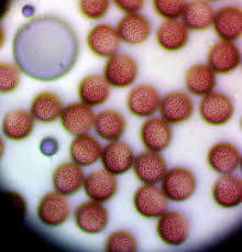 Attēlu rezultāti vaicājumam “Lamproderma pulchellum spores”