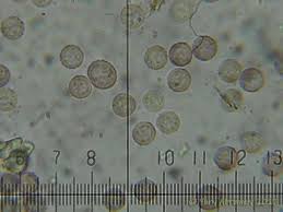 Attēlu rezultāti vaicājumam “Lindbladia tubulina spores”