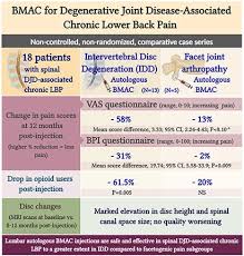 Image result for BMAC