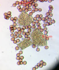Attēlu rezultāti vaicājumam “Craterium minutum cf. var. brunneum”