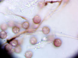 Attēlu rezultāti vaicājumam “Didymium megalosporum macro”