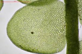 Attēlu rezultāti vaicājumam “Odontoschisma denudatum cells”