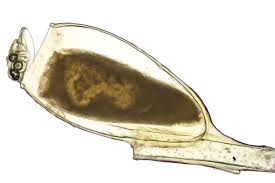 Attēlu rezultāti vaicājumam “Pediculus humanus capitis”