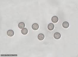 Attēlu rezultāti vaicājumam “Fuligo septica var. candida spores”