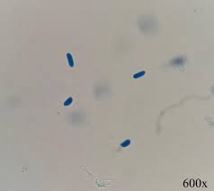 Attēlu rezultāti vaicājumam “Dacrymyces chrysospermus spores”