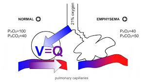 Image result for  v    q