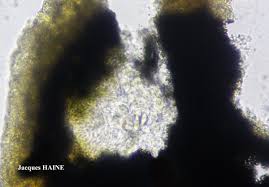 Attēlu rezultāti vaicājumam “Verrucaria hydrela”