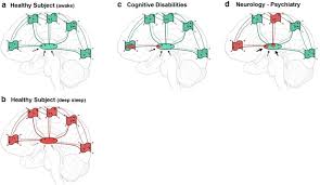 Image result for Withins Tc