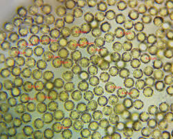 Attēlu rezultāti vaicājumam “Tubifera montana young”