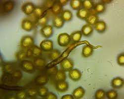 Attēlu rezultāti vaicājumam “Trichia contorta”