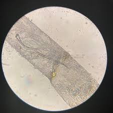 Attēlu rezultāti vaicājumam “Pilobolus crystallinus”