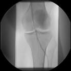 Was zeigt die <b>Angiographie</b>,