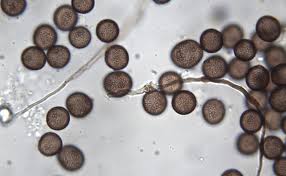 Attēlu rezultāti vaicājumam “Didymium sp.”