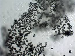 Attēlu rezultāti vaicājumam “Arcyria cinerea stalked”