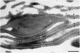 Attēlu rezultāti vaicājumam “Lycogala persicum spores”