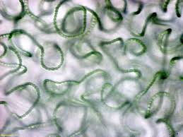 Attēlu rezultāti vaicājumam “Nostoc pruniforme cells”