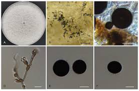 Attēlu rezultāti vaicājumam “Badhamia affinis var. microspora spores”