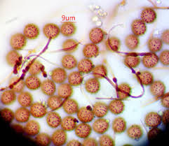 Attēlu rezultāti vaicājumam “Diderma floriforme”