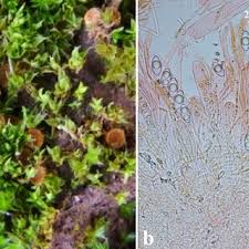 Attēlu rezultāti vaicājumam “Heterotrichia pomiformis (syn. Arcyria pomiformis) spores”