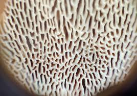 Attēlu rezultāti vaicājumam “Trametes gibbosa”