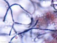 Attēlu rezultāti vaicājumam “Arcyria major”