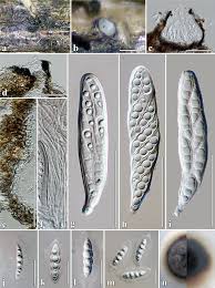 Attēlu rezultāti vaicājumam “Amaurochaete fusiformis spores”