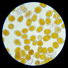 Attēlu rezultāti vaicājumam “Coleosporium sp.”