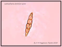 Attēlu rezultāti vaicājumam “Urocystis anemones spores”