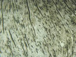 Attēlu rezultāti vaicājumam “Xylographa paralella”