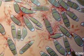 Attēlu rezultāti vaicājumam “Bactridium flavum”