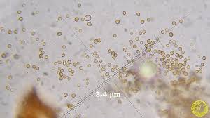 Attēlu rezultāti vaicājumam “Chaenotheca brunneola”