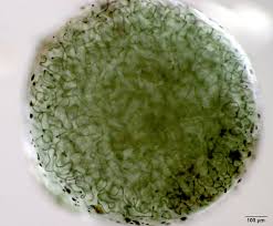 Attēlu rezultāti vaicājumam “Nostoc pruniforme cells”