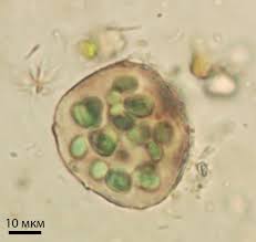 Attēlu rezultāti vaicājumam “Gloeocapsa rupestris”