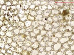 Attēlu rezultāti vaicājumam “Jungermannia sphaerocarpa”