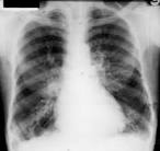 Internal Medicine