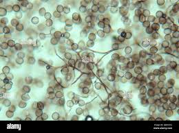 Attēlu rezultāti vaicājumam “Comatricha elegans stalked”